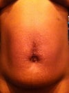 Tummy only