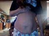Night before tummy tuck