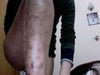 Left leg