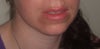 shadow below my bottom lip