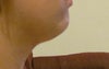 Side