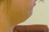Side, looking down slightly