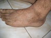 left foot closeup