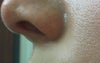 the nostril is being pulled up, the columella is very visible from my left side. I hate this side,