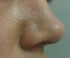 the columella and the nostril are very even, i really like this side