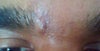 Vaseline applied