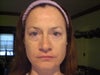 morning before surgery 10/14/11