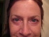 11/29/11 - 12 days after shots