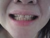 Picture of my teeth