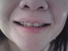 Picture of my teeth 2