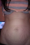tummy