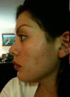 profile after