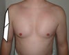 21 days post-op