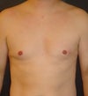 My "before" pic