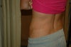 6 months post lipo