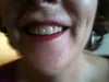 Will the ematrix help with my wrinkles?