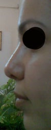 profile now (3months and half)