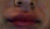 as you can tell my upper lip is quite swollen, and give it that ape look