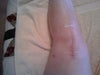 Left knee