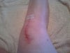 Right knee