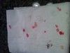 This is the blood on tissue that I used to absorb it out