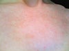 chest veins
