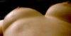 Hard to get a good pic of this but when I lay down the R breast flattens out and the implant feels like it is sliding into my armpit. The left breast stays perky and firm and the implant does not move. I am also having a lot of chest pain on the right.