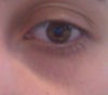 Eye