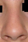 front view. Too much nostril showing already.