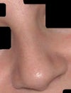 Nose is too bulbous at the tip. Nostrils are to big and wide wide at the bridge. I wouldnt want to lift the tip anymore as i would look like a pig.