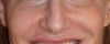 uneven and bulbous