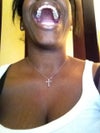 On this photo you can see the implant is very small compare to the crown on the other side.