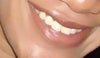 Lips in 2008 (smiling)