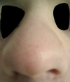 Slight angle view