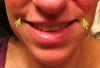 my smile with the puffiness looks strange.