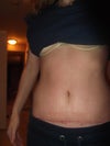 skin feels pulled toward front. tight in center looser on sides.