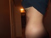 side view after