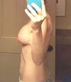 Right side view of breast that is still falling (and the side I have more tingling/numbness on).
