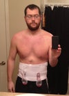 1 Day Post-OP.  Center Chest above garment