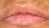 outer lips