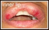 inner lips