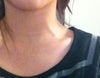 left neck vein pops out when talking normally