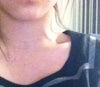 left neck vein pops out when talking normally