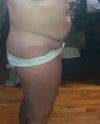 Side view before TT