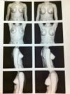 My before is on the left side and after is on the right