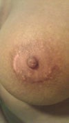 my left breast looks alot better