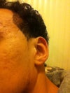 Picture of cheeks