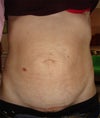 frontal