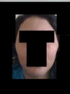 front face