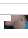 no definition between bottom face and neck